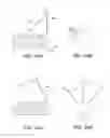 Fig. 29 - Intraocular delivery devices and methods therefor