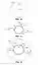 Fig. 07 - Intraocular lens