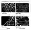 Fig. 01 - Hemostatic textile