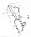 Fig. 06 - Gait belt