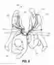 Fig. 08 - Gait belt