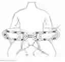 Fig. 01 - Gait Belt