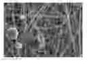 Fig. 01 - STACKED BODY AND SHEET FOR APPLICATION TO SKIN