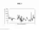 Fig. 02 - Method of using composition containing Thunb. extract as active ingredient for prevention and treatment of bone diseases