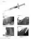 Fig. 02 - Hemostatic composition and hemostatic method using hemostatic composition