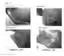 Fig. 03 - Hemostatic composition and hemostatic method using hemostatic composition
