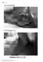 Fig. 05 - Hemostatic composition and hemostatic method using hemostatic composition