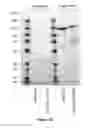 Fig. 15 - Immunogenic construct comprising an EBV-cell antigen and a targeting moiety and applications thereof