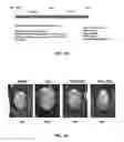 Fig. 41 - Compositions and methods for increasing efficiency of cardiac metabolism