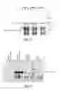 Fig. 07 - Human alpha-N-acetylgalactosaminidase polypeptide