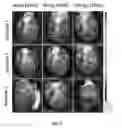 Fig. 10 - Compositions and methods for expression of multiple biologically active polypeptides from a single vector for treatment of cardiac conditions and other pathologies