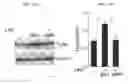 Fig. 22 - Compositions and methods for treating or ameliorating neuroinflammation, neurodegeneration, neuropathic pain, and migraine