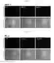 Fig. 06 - Method of using methylene blue nanoparticle for detecting cancer by bioimaging