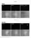 Fig. 07 - Method of using methylene blue nanoparticle for detecting cancer by bioimaging