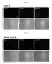 Fig. 08 - Method of using methylene blue nanoparticle for detecting cancer by bioimaging