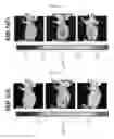 Fig. 16 - Method of using methylene blue nanoparticle for detecting cancer by bioimaging