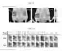 Fig. 17 - Method of using methylene blue nanoparticle for detecting cancer by bioimaging