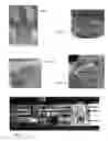 Fig. 07 - Decellularized and demineralized bone matrices and methods for making same