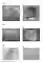 Fig. 02 - Decellularized placental membrane and methods of preparing and use thereof