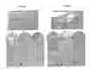 Fig. 08 - Patch graft compositions for cell engraftment