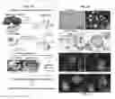 Fig. 02 - PATCH GRAFT COMPOSITIONS FOR CELL ENGRAFTMENT