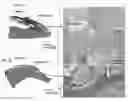 Fig. 07 - PATCH GRAFT COMPOSITIONS FOR CELL ENGRAFTMENT