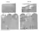 Fig. 08 - PATCH GRAFT COMPOSITIONS FOR CELL ENGRAFTMENT