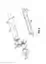 Fig. 07 - POWER ASSISTED LIPOPLASTY