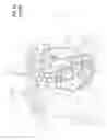 Fig. 02 - Inflow cannula tunneling tool allowing quick exchange with dilating plug