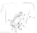 Fig. 01 - Implantable heart pump