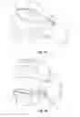 Fig. 03 - Positive pressure ventilation appliance modules and related systems and methods