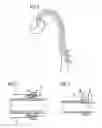Fig. 02 - Catheter device having a catheter and an actuation device