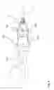 Fig. 05 - EXTRACTION DEVICE FOR COLLECTING BLOOD SAMPLES, INCLUDING A CATHETER AND A SAFETY SYSTEM