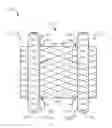Fig. 01 - Systems and methods for creating permanent drainage fistula