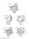 Fig. 09 - Apparatus and Methods for Charging an Implanted Medical Device Power Source