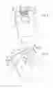 Fig. 06 - VEHICLE AIRBAG