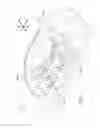 Fig. 02 - Vehicle airbag