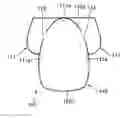 Fig. 01 - Vehicular airbag device