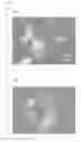 Fig. 04 - Glass having exceptional crack resistance