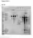 Fig. 06 - Virus-like particle with efficient epitope display