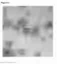 Fig. 07 - Virus-like particle with efficient epitope display