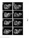 Fig. 02 - Mutant fragments of OspA and methods and uses relating thereto