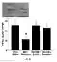 Fig. 07 - Compositions and methods for treating opioid tolerance