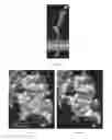 Fig. 08 - Compositions and methods for treating cardiac dysfunction