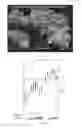 Fig. 09 - Compositions and methods for treating cardiac dysfunction