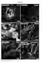 Fig. 08 - Method for differentiating induced pluripotent stem cells, which are prepared from endocardium-derived adult stem cells, into cardiovascular cells, and use thereof