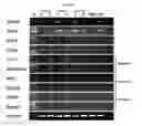 Fig. 09 - Method for differentiating induced pluripotent stem cells, which are prepared from endocardium-derived adult stem cells, into cardiovascular cells, and use thereof