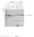 Fig. 09 - POLYMERIZING ENZYMES FOR SEQUENCING REACTIONS