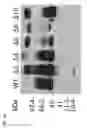 Fig. 06 - Methods of purifying recombinant alpha-Galactosidase A
