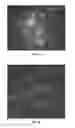 Fig. 05 - Reporter system for detecting and targeting activated cells